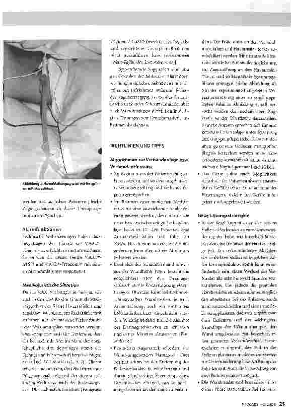 Vorschauseite 4: Die neue Form der Abdominellen Vakuumtherapieim Fokus der therapeutischen und pflegerischen Vernetzung.