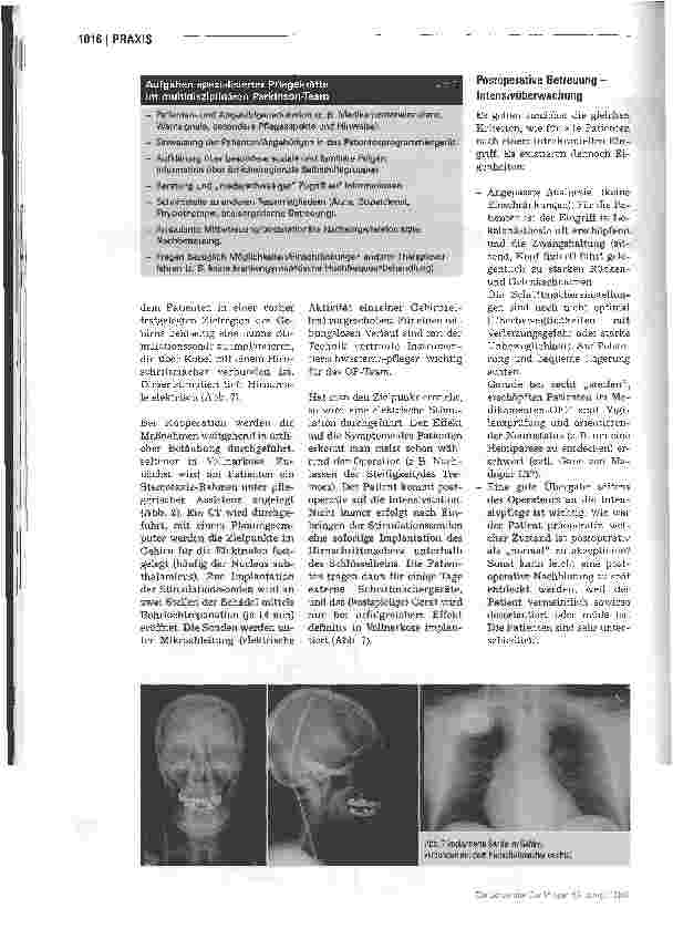 Vorschauseite 5: Tiefenhirnstimulation - Perioperative Betreuung von Parkinson-Patienten