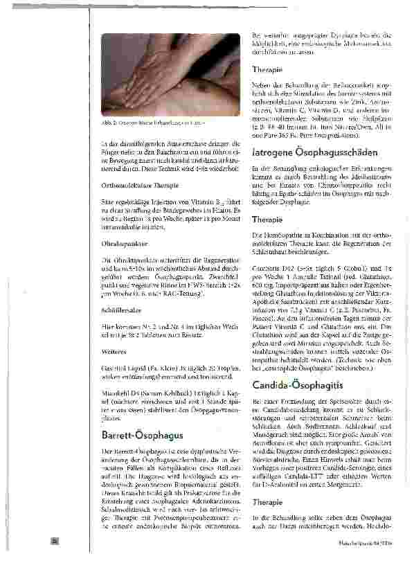 Vorschauseite 5: Osophagus Pathologie und Therapiemöglichkeiten