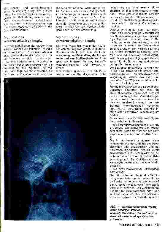 Vorschauseite 3: Die akuten arteriellen Durchblutungsstörungen des Gehirns - Teil 2