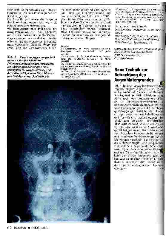 Vorschauseite 4: Die akuten arteriellen Durchblutungsstörungen des Gehirns - Teil 2