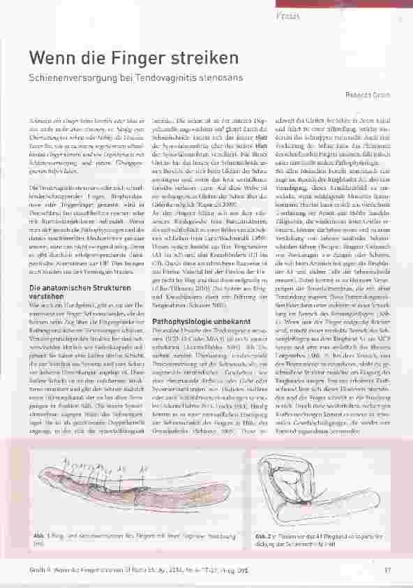 Vorschauseite 1: Wenn die Finger streiken Schienenversorgung bei Tendovaginitis stenosans