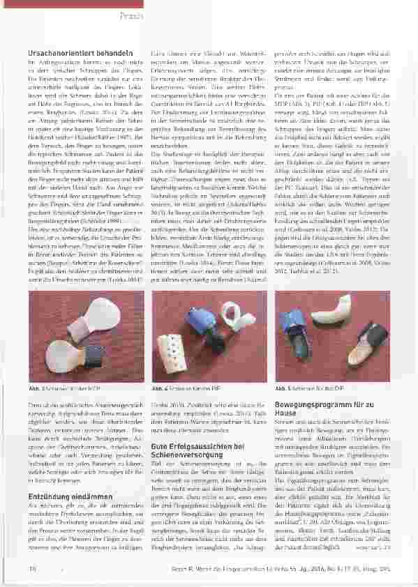 Vorschauseite 2: Wenn die Finger streiken Schienenversorgung bei Tendovaginitis stenosans