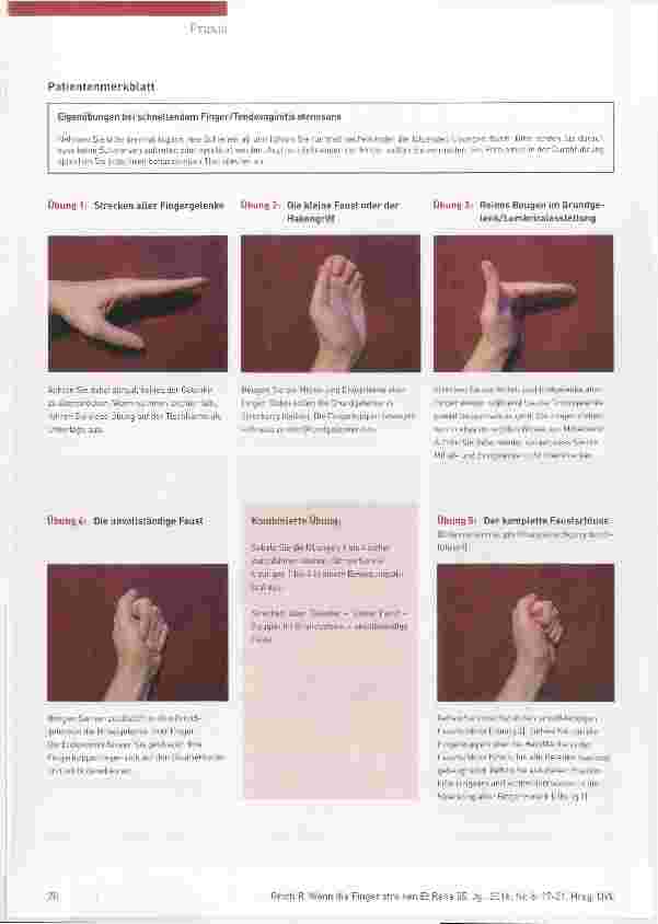 Vorschauseite 4: Wenn die Finger streiken Schienenversorgung bei Tendovaginitis stenosans
