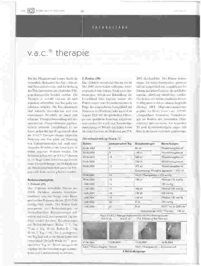 Vorschauseite 3: Die V. A. C. Therapie bei postoperativ persistierenden Lymphfisteln und Lymphozelen nach gefäßchirurgischen Eingriffen - erste Ergebnisse