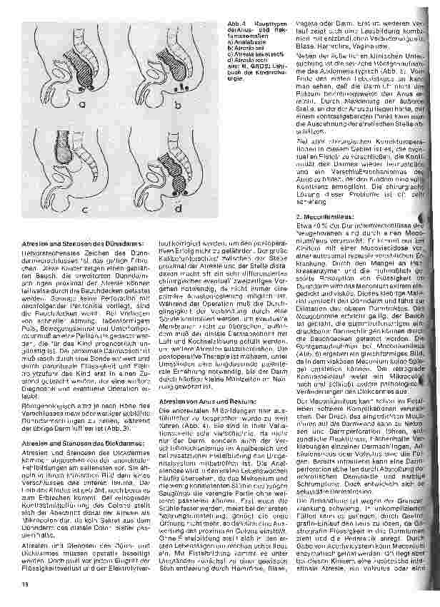 Vorschauseite 3: Kinderheilkunde Vererbte Krankheiten 9. Folge: Darmunwegsamkeiten im Neugeborenenund Säuglingsalter