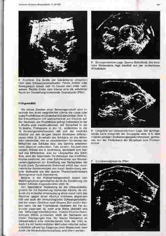 Vorschauseite 2: Ultraschalldiagnostik in der Geburtshilfe