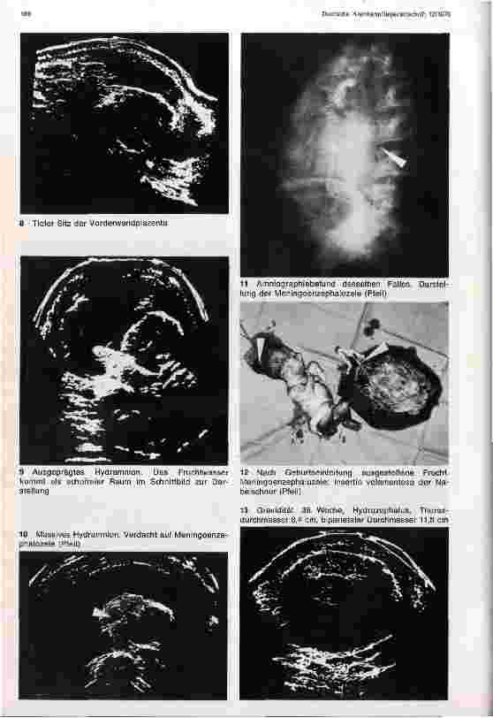 Vorschauseite 3: Ultraschalldiagnostik in der Geburtshilfe