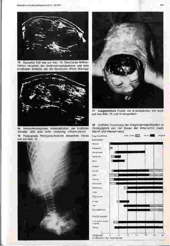 Vorschauseite 4: Ultraschalldiagnostik in der Geburtshilfe