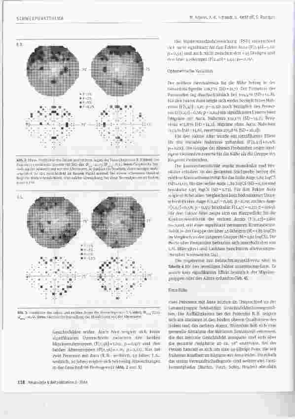 Vorschauseite 4: Dauerhafte Veränderungen visueller Leistungen bei Migräne? Ein Vergleich zwischen Migräne mit und ohne Aura