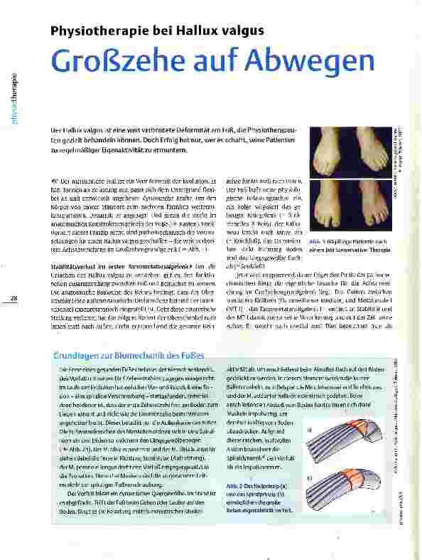 Vorschauseite 1: Physiotherapie bei Hallux valgus Großzehe auf Abwegen