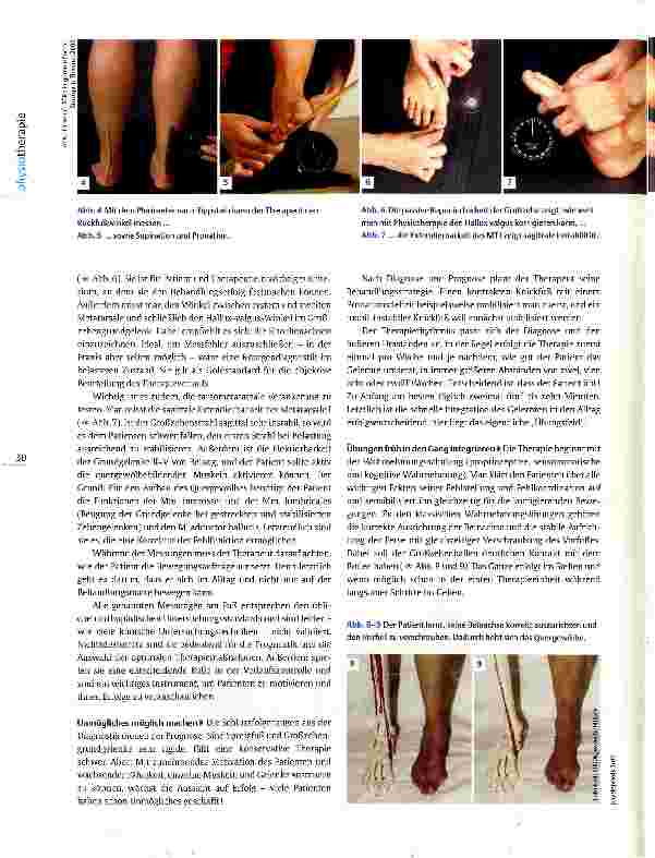Vorschauseite 3: Physiotherapie bei Hallux valgus Großzehe auf Abwegen