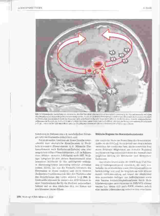 Vorschauseite 3: Schwere Bewusstseinsstörungen in der neurologisch-neurochirurgischen Frührehabilitation
