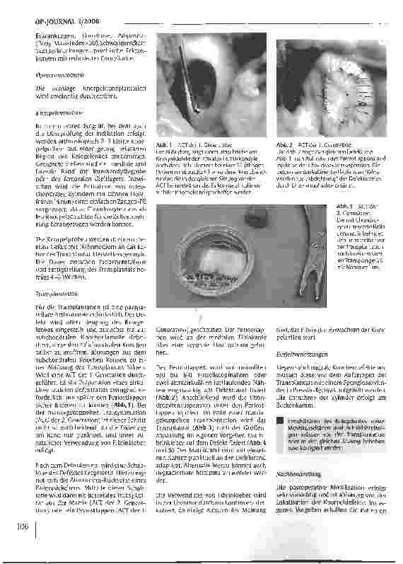 Vorschauseite 3: Klinische Erfahrungen mit der autologen Knorpeltransplantation (ACT)