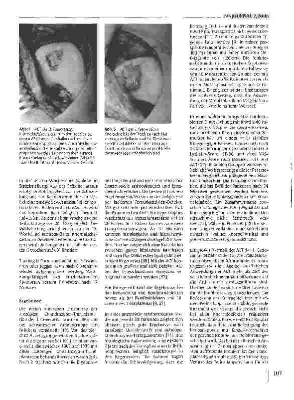 Vorschauseite 4: Klinische Erfahrungen mit der autologen Knorpeltransplantation (ACT)