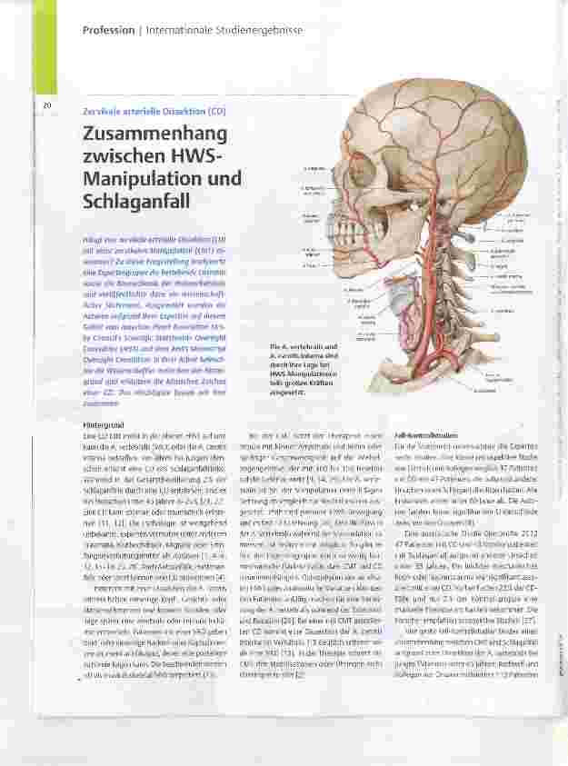 Vorschauseite 1: Zusammenhang zwischen HWS- Manipulation und Schlaganfall