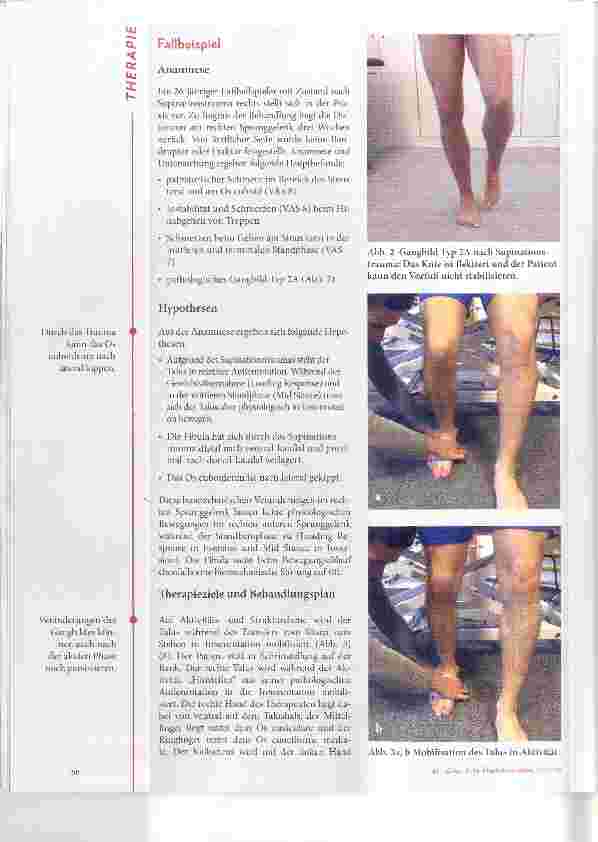 Vorschauseite 3: Supinationstrauma: Gangabweichungen im Fokus