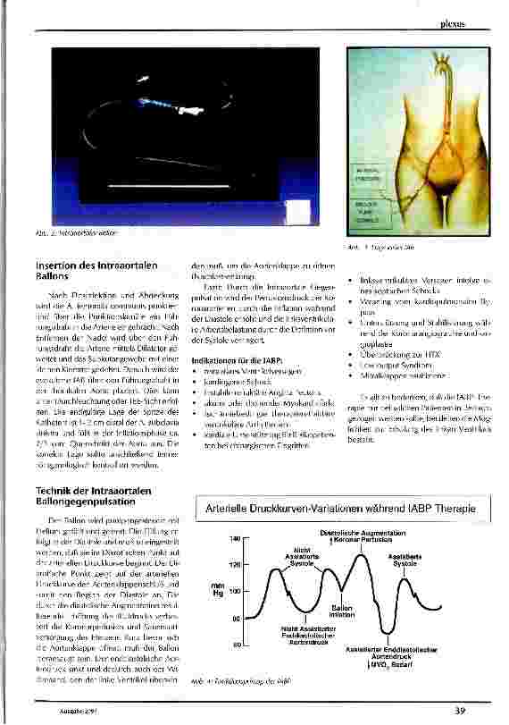 Vorschauseite 2: Intraaortale Ballonpumpe (IABP) Pflege eines Patienten mit IABP-Therapie