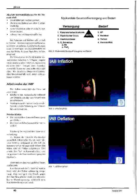 Vorschauseite 3: Intraaortale Ballonpumpe (IABP) Pflege eines Patienten mit IABP-Therapie