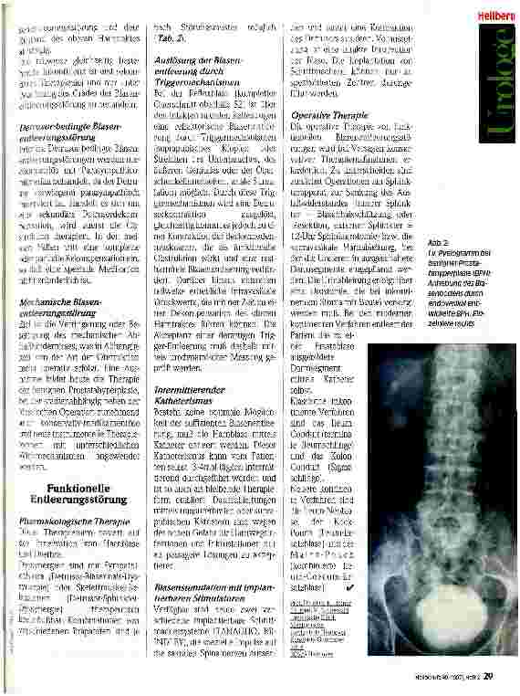 Vorschauseite 2: Blasenentleerungsstörungen