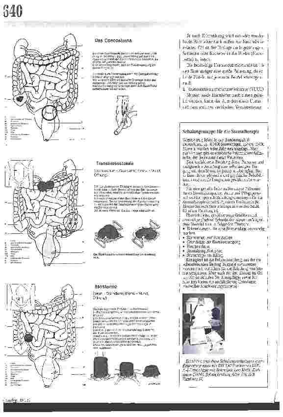 Vorschauseite 2: Stomaarten Stoma - was ist das eigentlich?