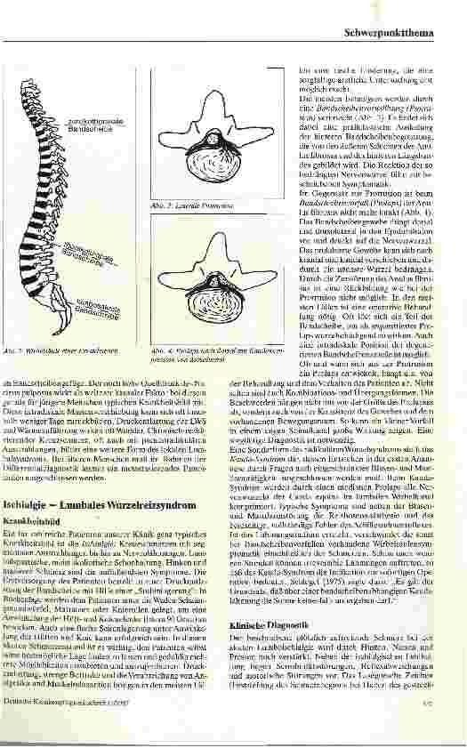 Vorschauseite 2: Lumbago, Ischialgie und lumbaler Bandscheibenvorfall