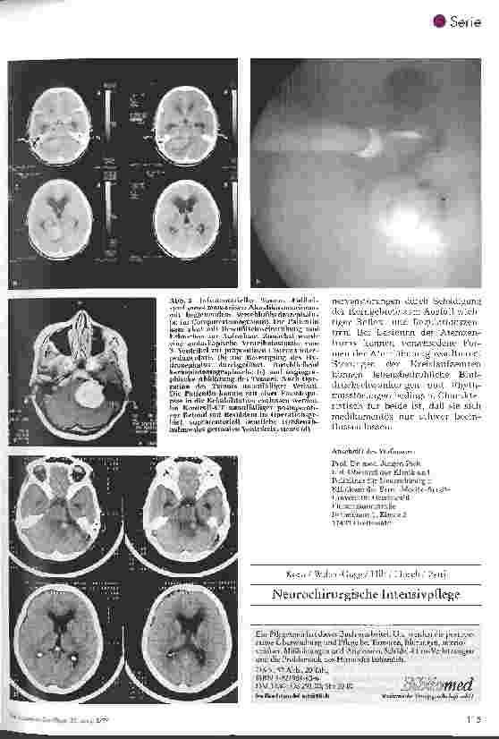 Vorschauseite 4: Postoperative Pflege in der Neurochirurgie 5. Folge: Postoperative Überwachung nach Operationen intrakranieller Tumoren