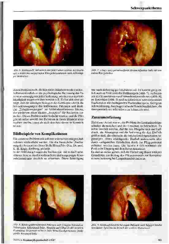 Vorschauseite 6: Cuffinduzierte Schäden des Kehlkopfes und der Trachea