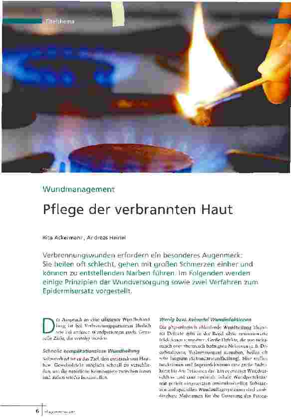 Vorschauseite 1: Wundmanagement - Pflege der verbrannten Haut