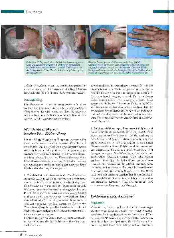 Vorschauseite 3: Wundmanagement - Pflege der verbrannten Haut