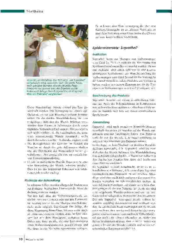 Vorschauseite 5: Wundmanagement - Pflege der verbrannten Haut
