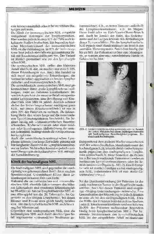Vorschauseite 3: Klinik und Therapie der Non-Hodgkin-Lymphome