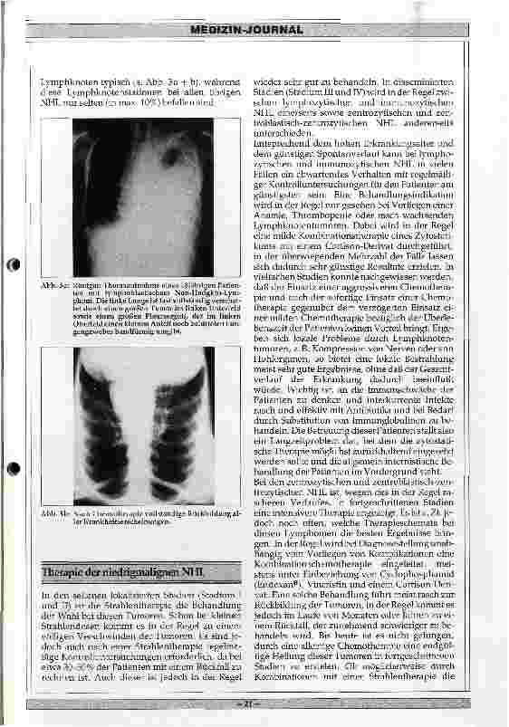 Vorschauseite 4: Klinik und Therapie der Non-Hodgkin-Lymphome