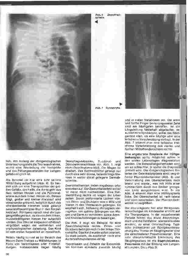 Vorschauseite 3: Radiologie Eine Einführung für Krankenschwestern und Pfleger 33. Folge: Röntgenuntersuchungen im Kindesalter