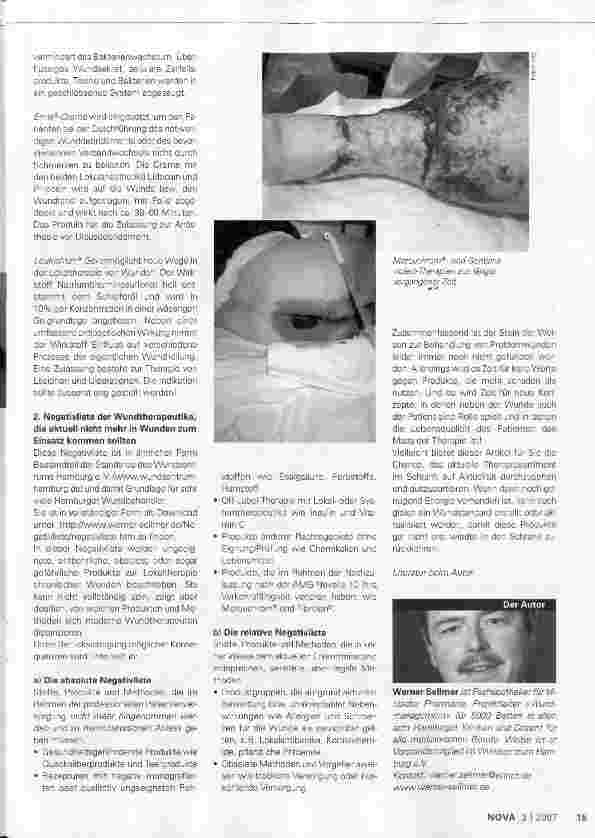 Vorschauseite 4: Lokaltherapie chronischer Wunden
