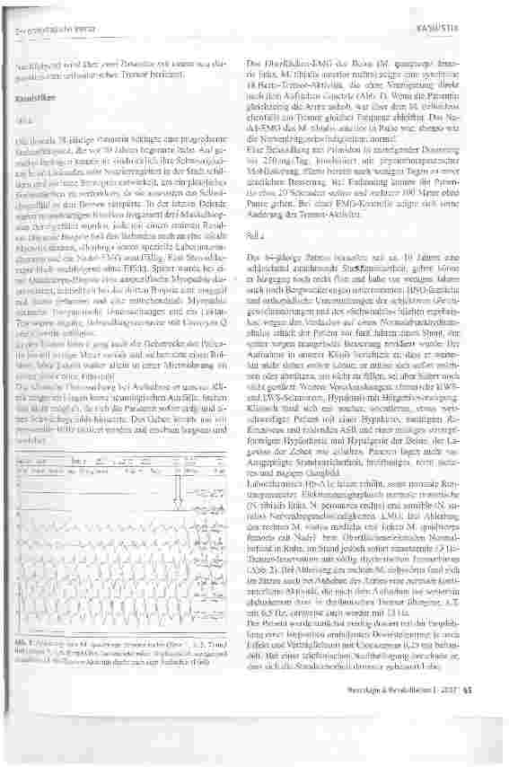 Vorschauseite 2: Der orthostatische Tremor - eine gelegentliche Ursache der Standund Gangunsicherheit in der neurologischenRehabilitation