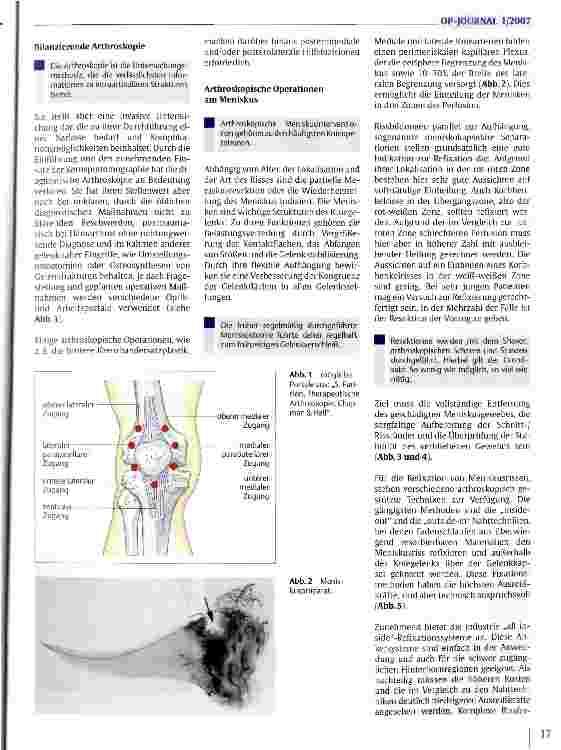 Vorschauseite 2: Arthroskopische Operationen des Kniegelenks