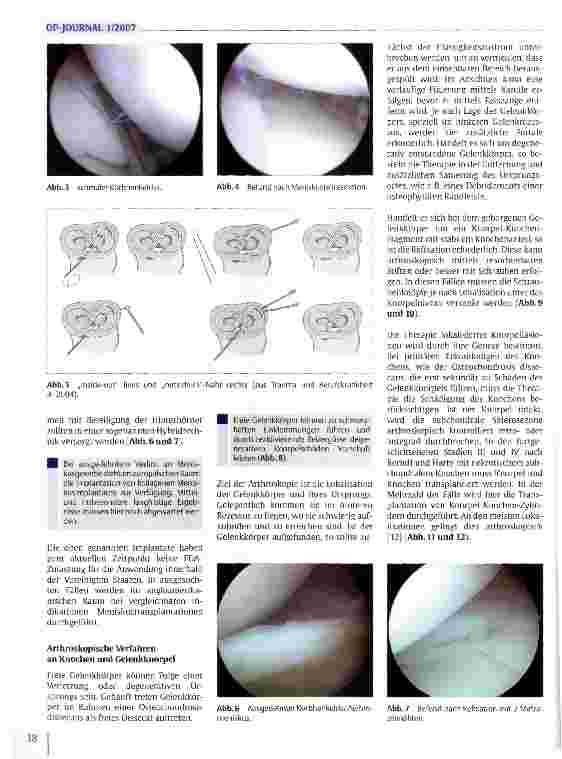 Vorschauseite 3: Arthroskopische Operationen des Kniegelenks