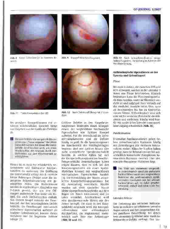 Vorschauseite 4: Arthroskopische Operationen des Kniegelenks