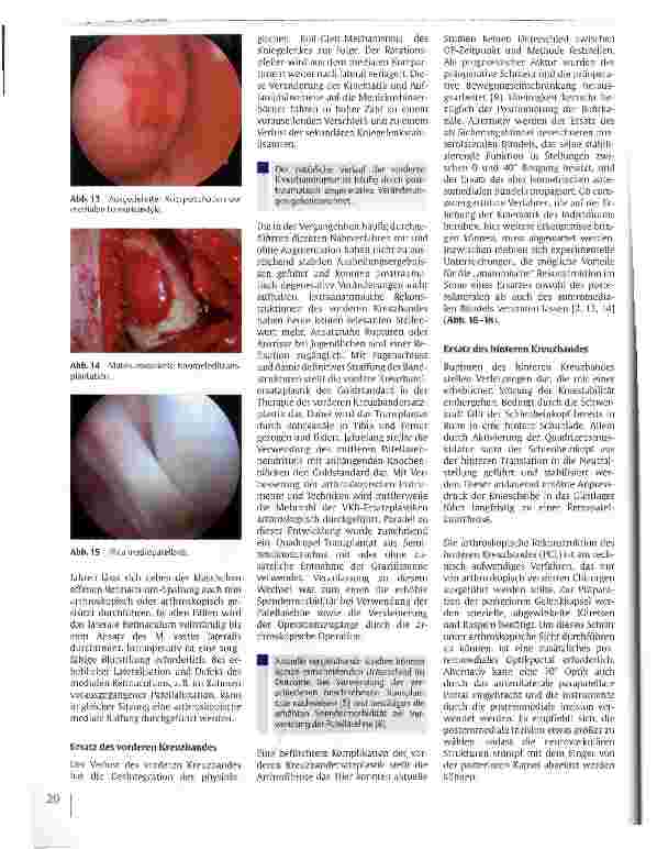 Vorschauseite 5: Arthroskopische Operationen des Kniegelenks