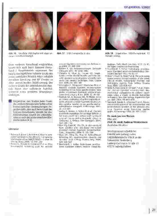 Vorschauseite 6: Arthroskopische Operationen des Kniegelenks