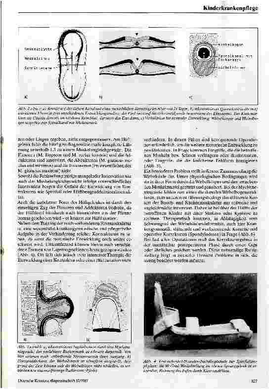 Vorschauseite 2: Die medizinische Rehabilitation des Spina bifida Kindes