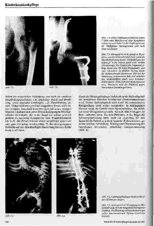 Vorschauseite 3: Die medizinische Rehabilitation des Spina bifida Kindes