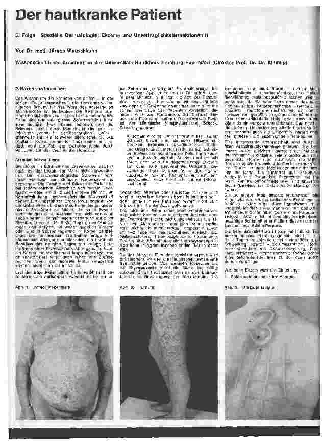 Vorschauseite 1: Der hautkranke Patient 5. Folge: Spezielle Dermatologie: Ekzeme und Unverträglichkeitsreaktionen II