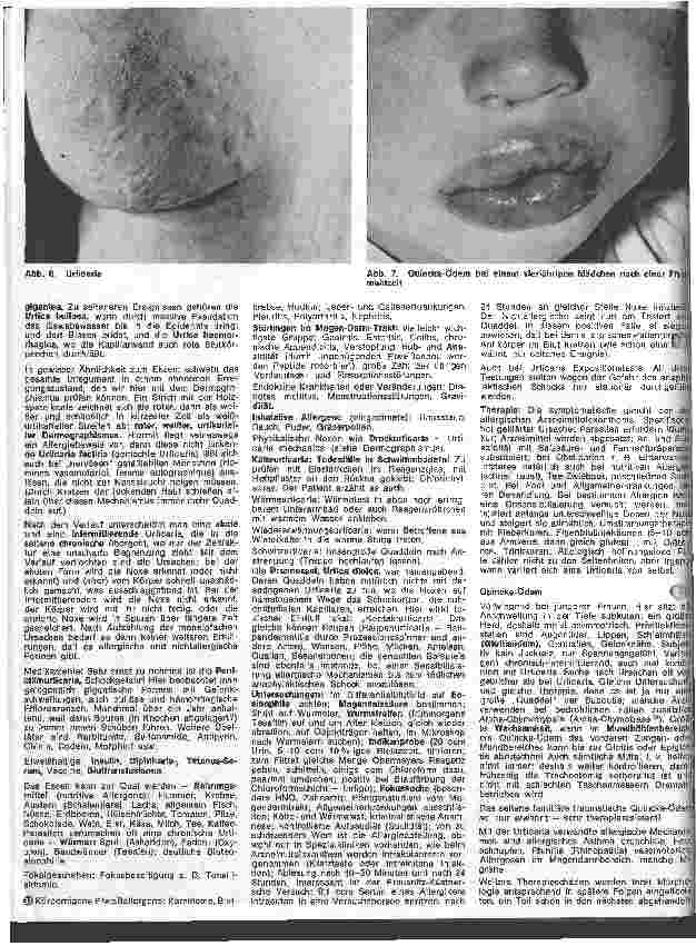 Vorschauseite 3: Der hautkranke Patient 5. Folge: Spezielle Dermatologie: Ekzeme und Unverträglichkeitsreaktionen II