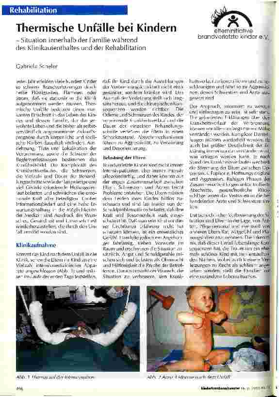Vorschauseite 1: Thermische Unfälle bei Kindern Situation innerhalb der Familie während des Klinikaufenthaltes und der Rehabilitation
