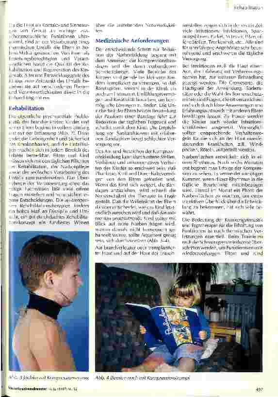 Vorschauseite 2: Thermische Unfälle bei Kindern Situation innerhalb der Familie während des Klinikaufenthaltes und der Rehabilitation