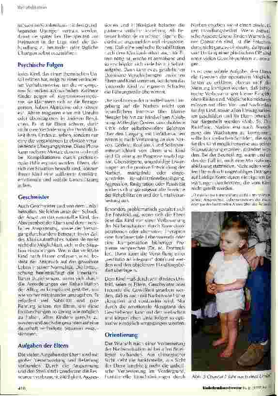 Vorschauseite 3: Thermische Unfälle bei Kindern Situation innerhalb der Familie während des Klinikaufenthaltes und der Rehabilitation