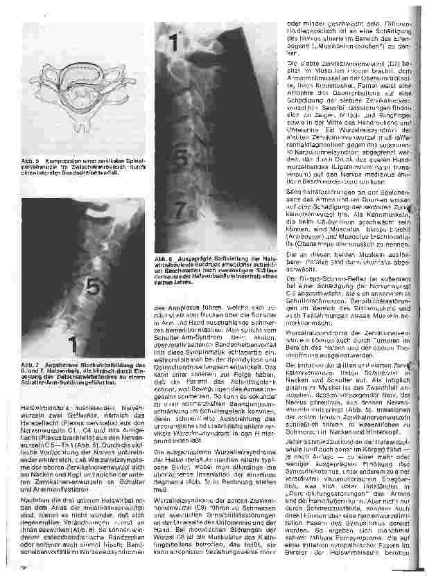 Vorschauseite 3: Themen aus der Neurochirurgie 5. folge: Das Zervikalsyndrom