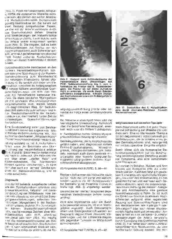 Vorschauseite 4: Themen aus der Neurochirurgie 5. folge: Das Zervikalsyndrom